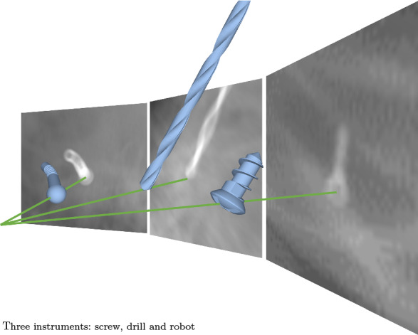 Fig. 1