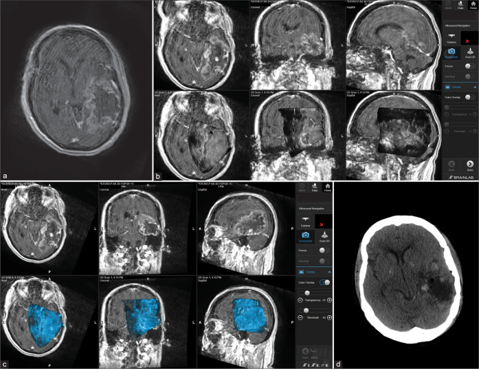 Figure 3: