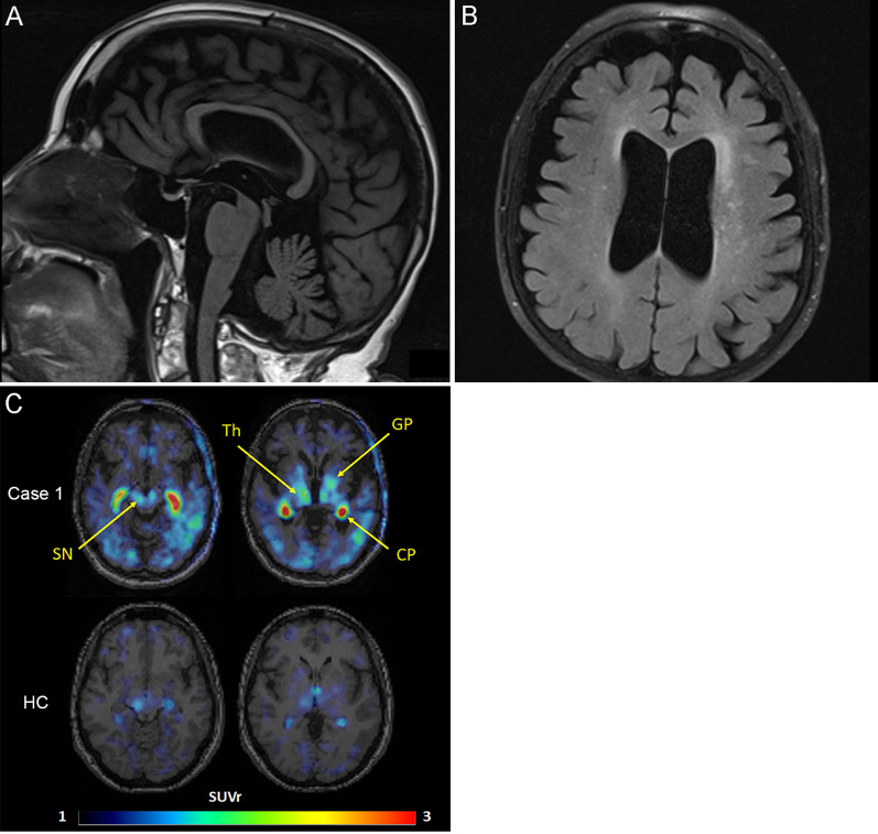 Fig. 1