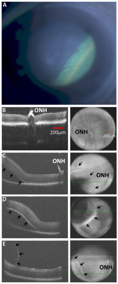 Figure 4: