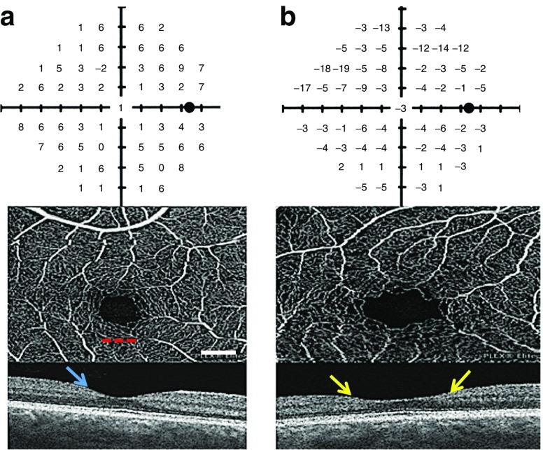 Fig. 3