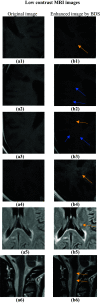 Fig. 8