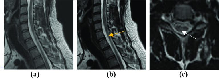 Fig. 10