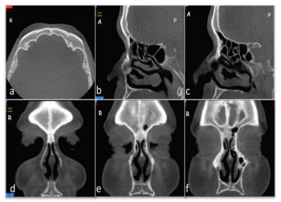 Fig 3