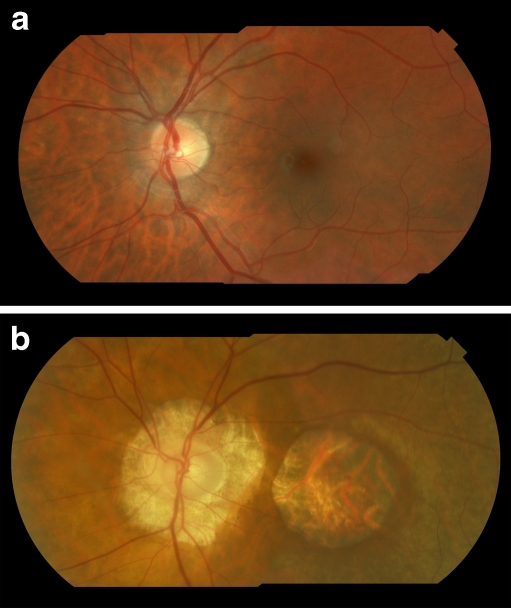 Fig. 3