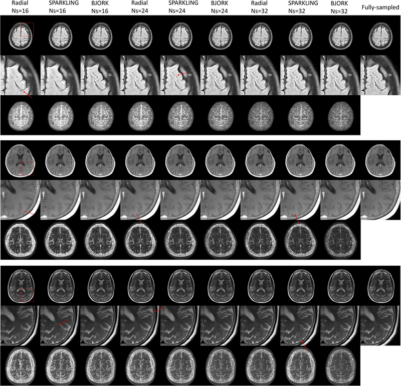 Fig. 11.