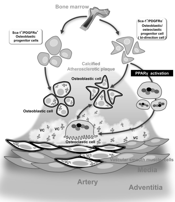 Illustration of calcifying progenitor cells and their proposed roles in atherosclerotic vascular calcification (VC). Sca-1+/PDGFRα- progenitor cells differentiate into osteoblasts/osteoclasts bi-directionally. PPARγ activation can shift the direction of Sca-1+/PDGFRα- progenitor cells toward osteoclasts.