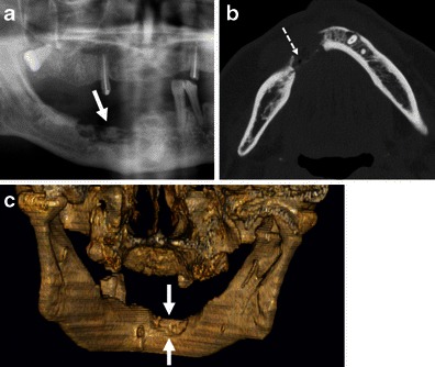 Fig. 11