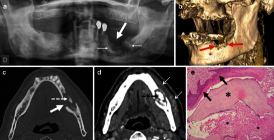 Fig. 10