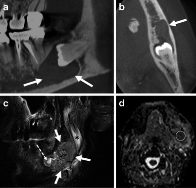 Fig. 17