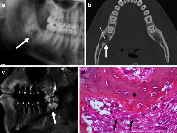 Fig. 13