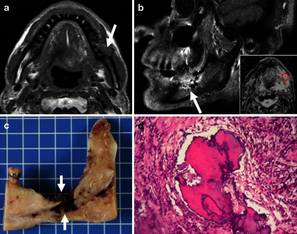 Fig. 12