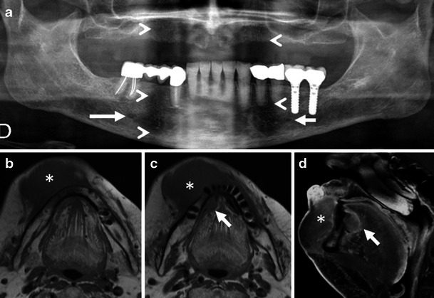 Fig. 18