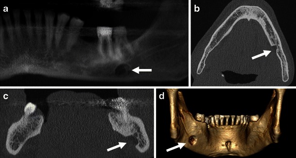 Fig. 16