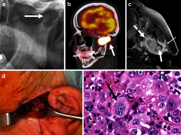 Fig. 15