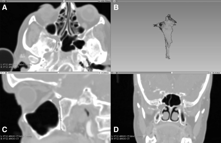 Fig. 1