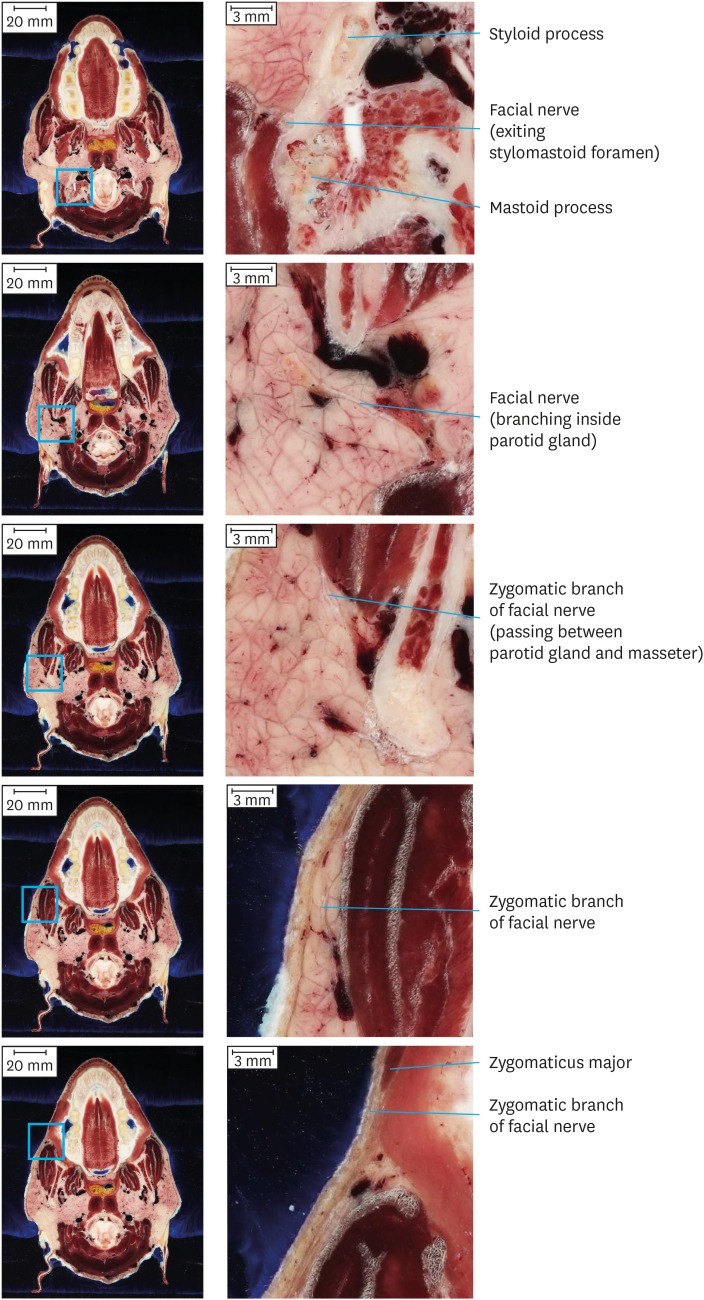 Fig. 8