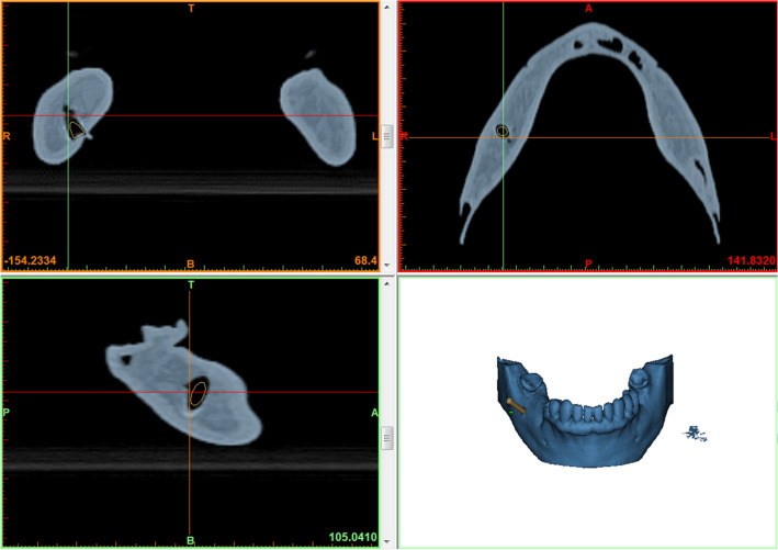 Fig. 7