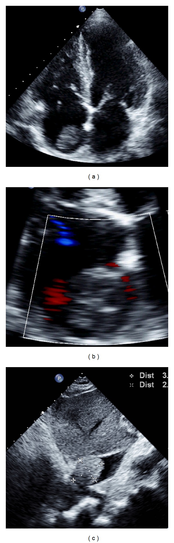 Figure 2