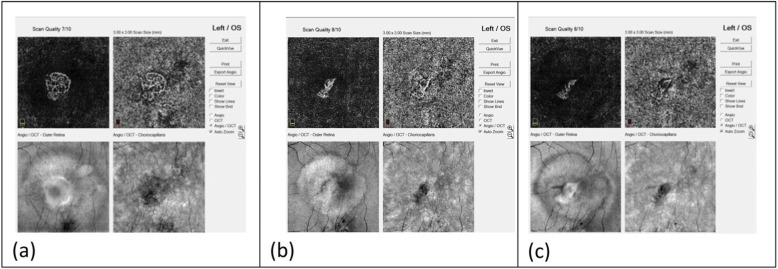 Fig. 4