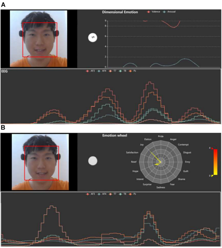 FIGURE 4