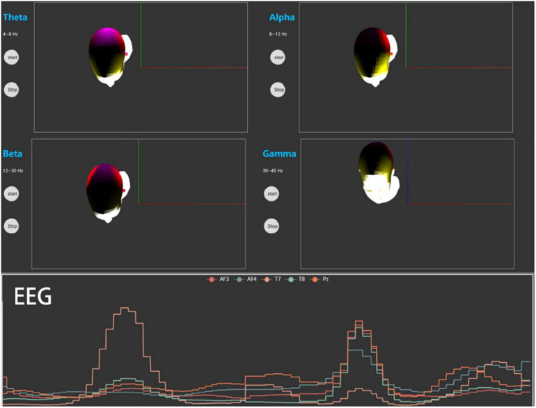 FIGURE 2