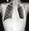 Figure 1a