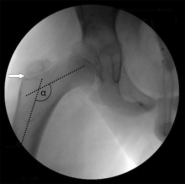 Fig. 1