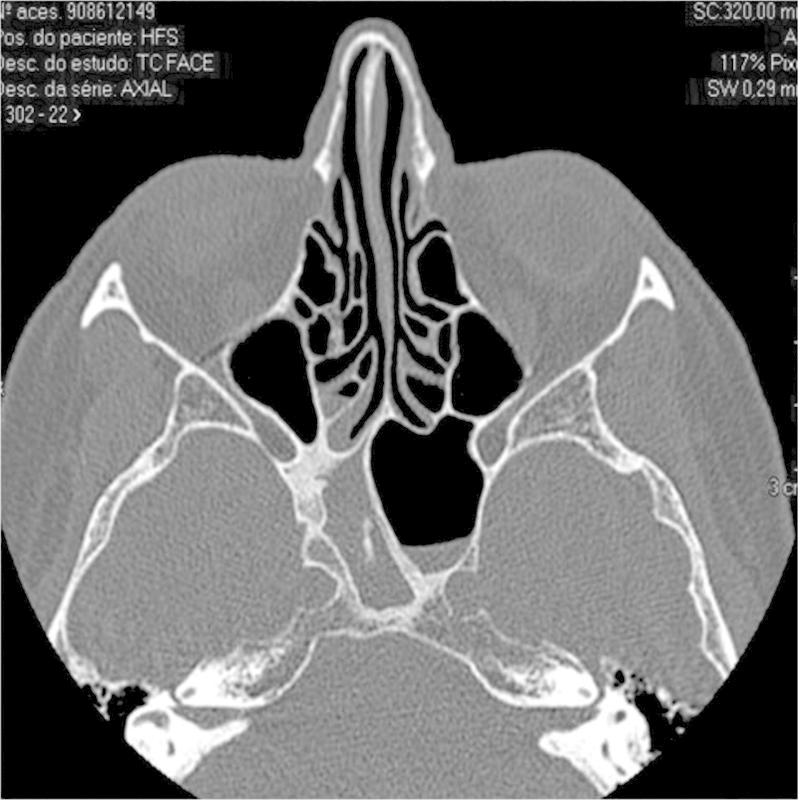 Differential Diagnosis and Treatment of Isolated Pathologies of the ...