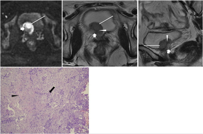 Figure 11