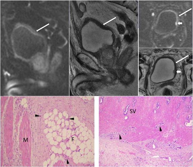 Figure 12