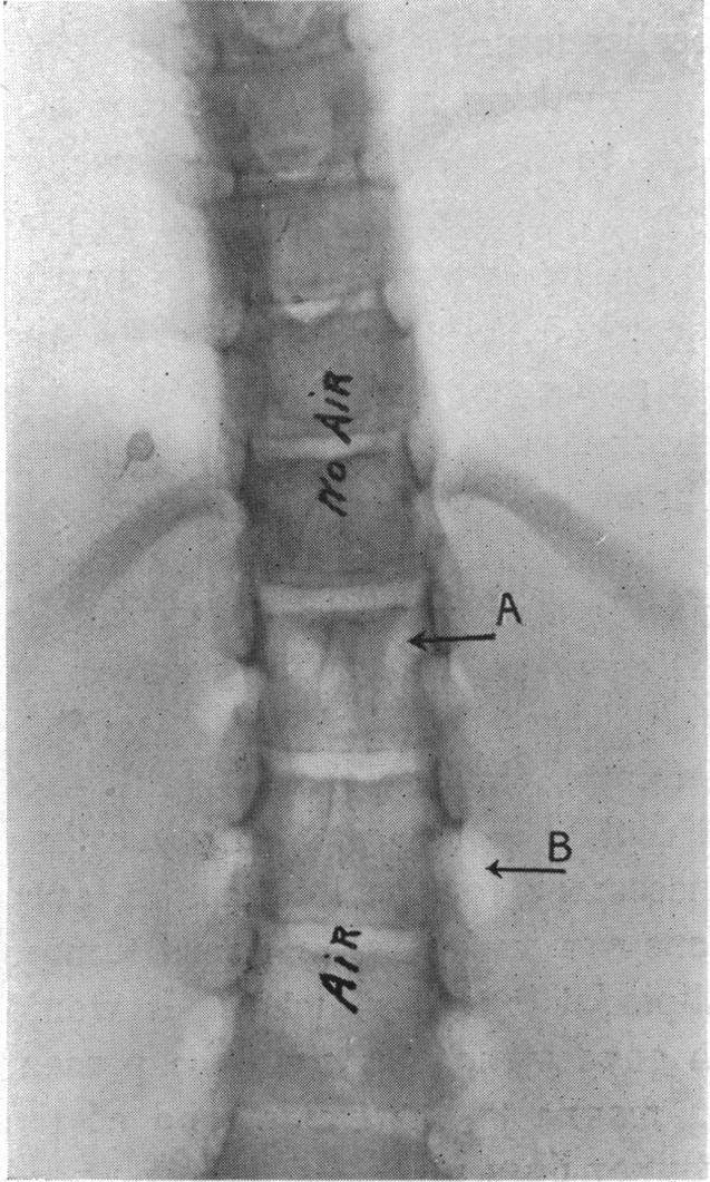 FIG. 16.