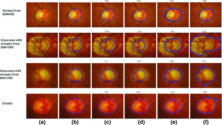 Fig. 13