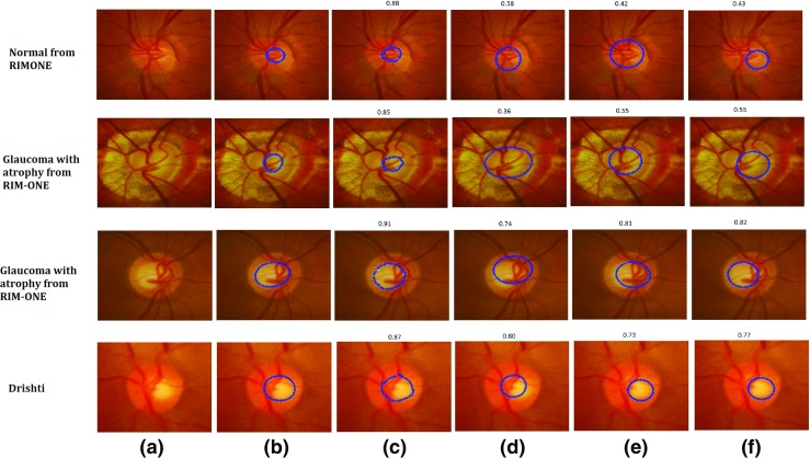 Fig. 14