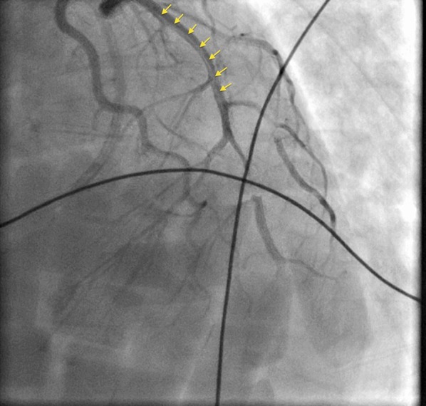 Fig. 2