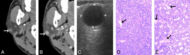 Fig 1.