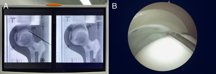 Fig. 2