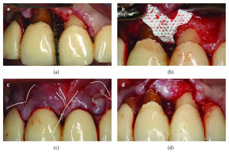 Figure 2