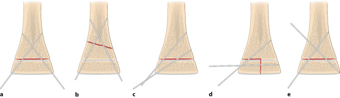 graphic file with name 64_2020_684_Fig17_HTML.jpg