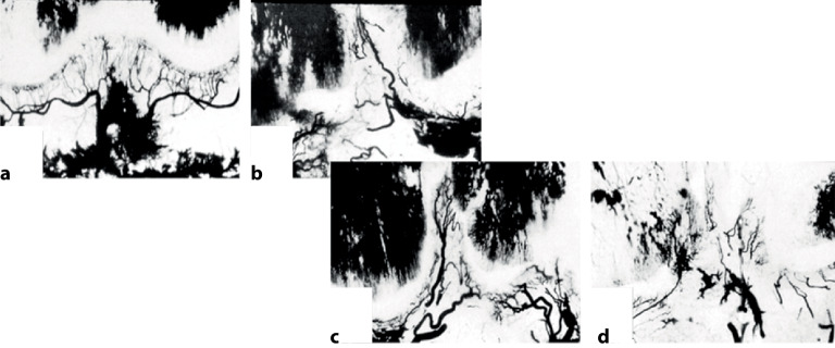 graphic file with name 64_2020_684_Fig15_HTML.jpg