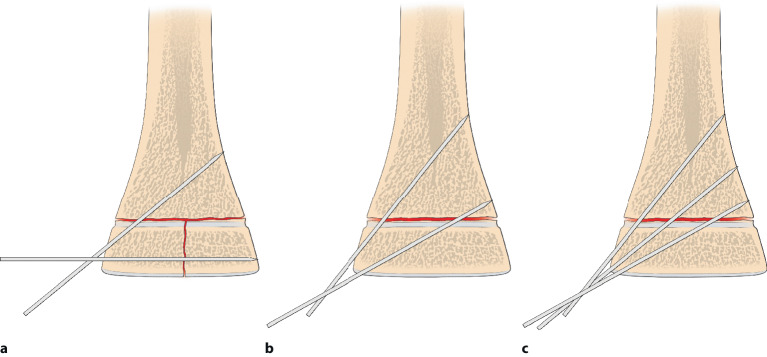 graphic file with name 64_2020_684_Fig23_HTML.jpg