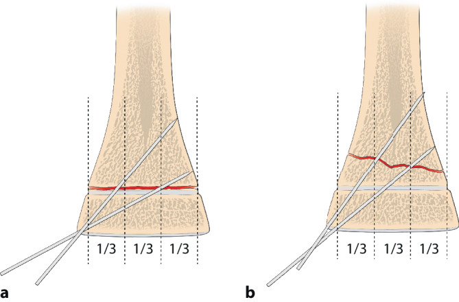 graphic file with name 64_2020_684_Fig19_HTML.jpg