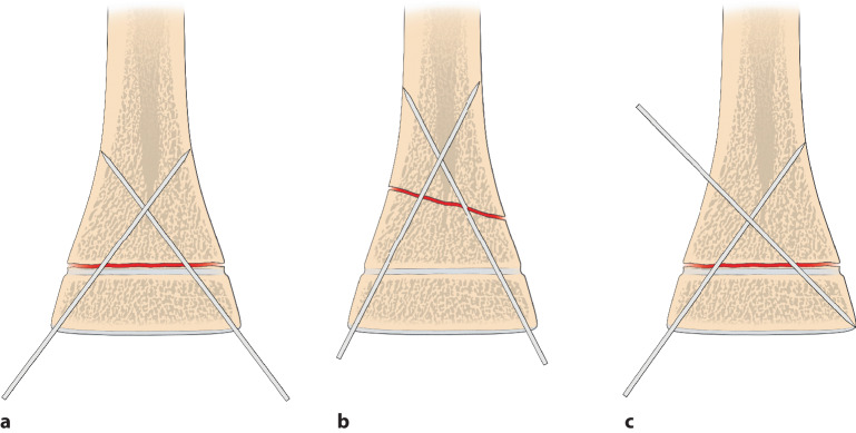 graphic file with name 64_2020_684_Fig25_HTML.jpg