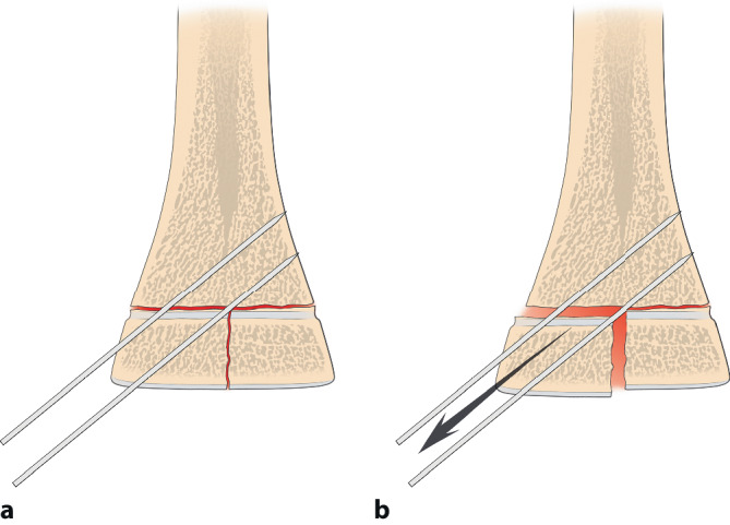 graphic file with name 64_2020_684_Fig21_HTML.jpg