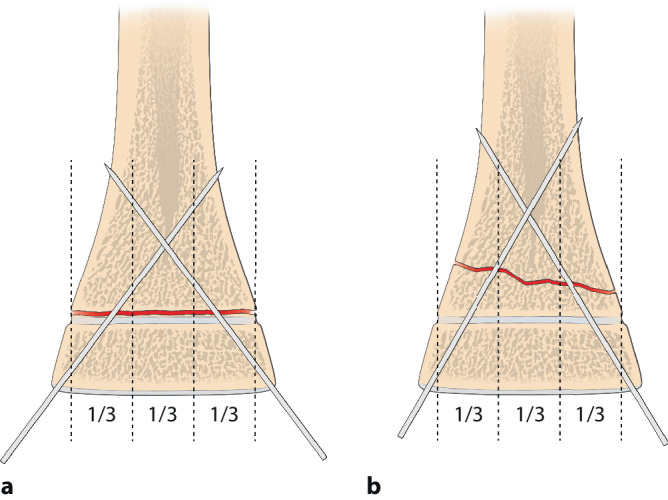 graphic file with name 64_2020_684_Fig18_HTML.jpg