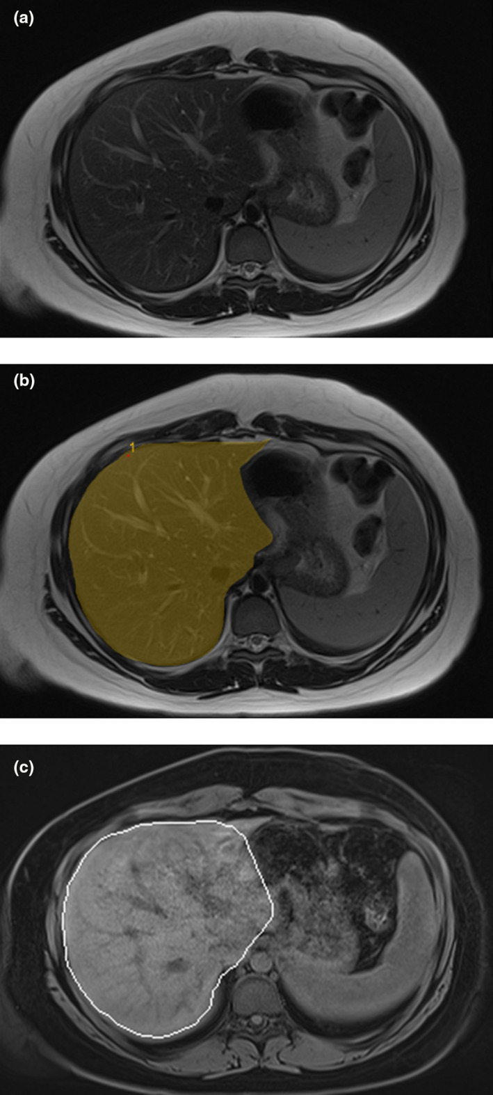 FIGURE 1