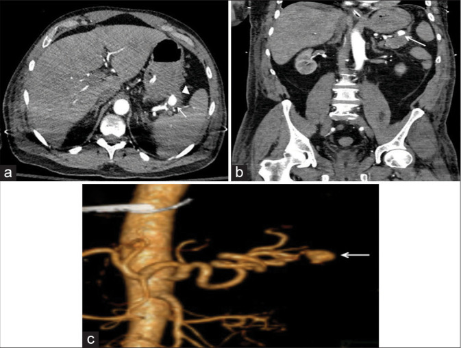 Figure 1: