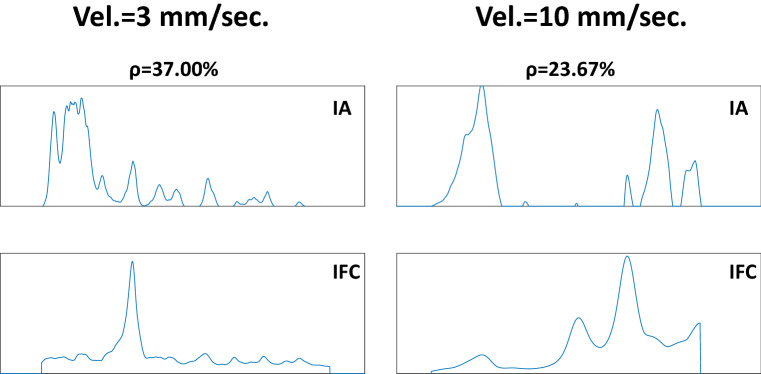 Fig. 14