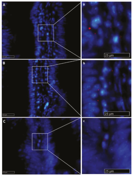 Figure 17