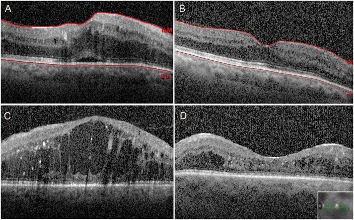 Fig 2